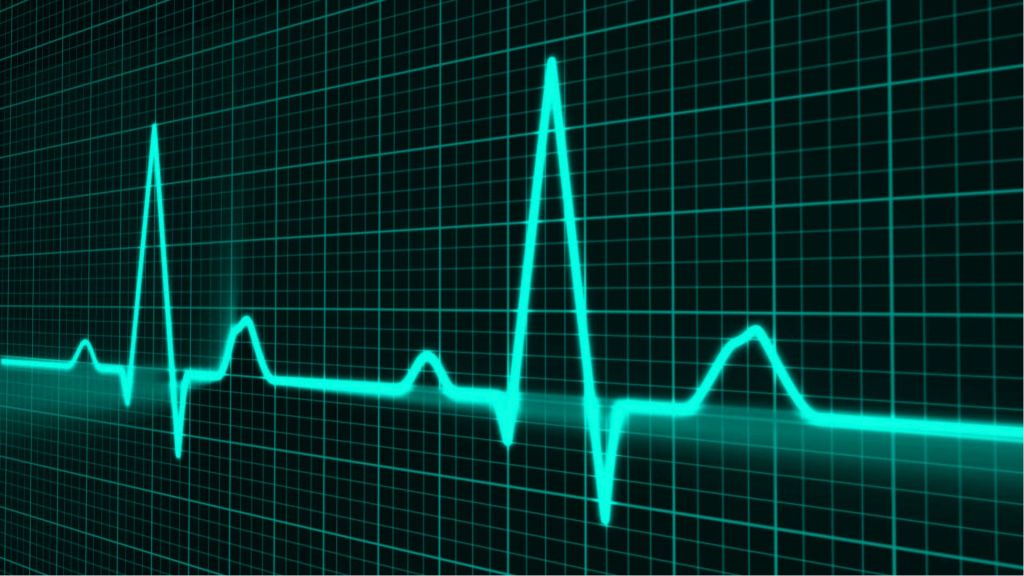 EKG - pulse rate display